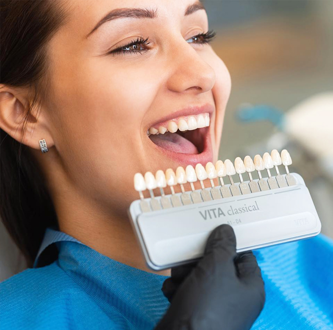 Woman comparing dental veneer shade guide to her natural smile during consultation.